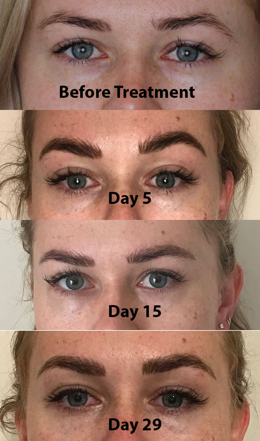 Microblading Progress Photographs